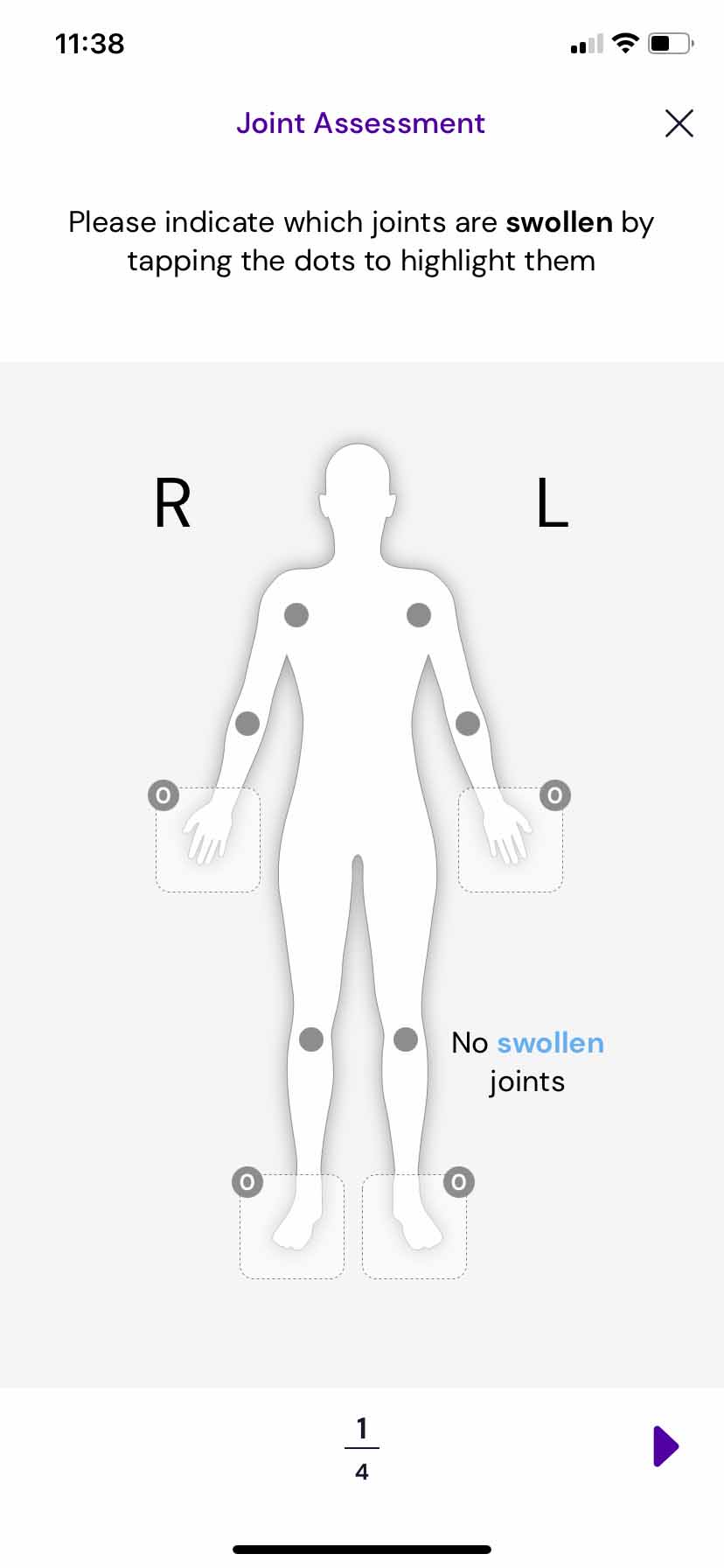 early inflammatory arthritis joint assessment app screenshot