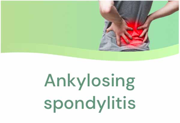 Ankylosing spondylitis