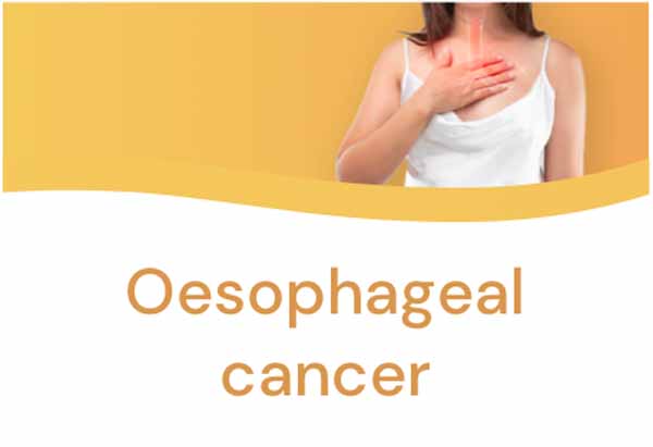 Oesophageal cancer